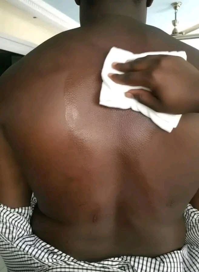 ANONYMAT: « Ma femme me frappe régulièrement »